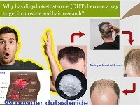 Hvorfor har DHT blitt et nøkkelmål i prostata- og hårforskning